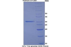 SDS-PAGE analysis of Human Otubain 1 Protein. (OTUB1 Protéine)