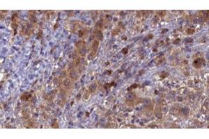 anti-CD3 epsilon (CD3E) (C-Term) antibody