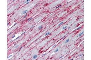 PNPT1 antibody was used for immunohistochemistry at a concentration of 4-8 ug/ml. (PNPT1 anticorps  (Middle Region))