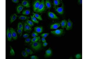 Immunofluorescence staining of A549 cells with ABIN7151851 at 1:400, counter-stained with DAPI.