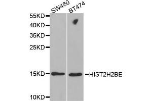 Western blot analysis of extracts of various cell lines, using HIST2H2BE antibody.