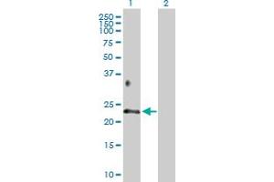Western Blot analysis of BTC expression in transfected 293T cell line by BTC MaxPab polyclonal antibody. (Betacellulin anticorps  (AA 1-178))