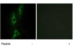 Immunofluorescence analysis of NIH/3T3 cells, using ADRB2 polyclonal antibody . (beta 2 Adrenergic Receptor anticorps  (C-Term))