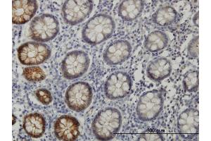 Immunoperoxidase of monoclonal antibody to EPHB3 on formalin-fixed paraffin-embedded human colon.