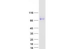 Validation with Western Blot