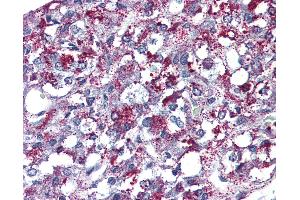Anti-AGTR2 antibody IHC of human adrenal.