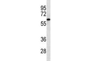 CAMKK2 western blot analysis in Jurkat lysate.
