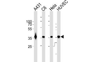 All lanes : Anti-GDH Antibody at 1:1000 dilution Lane 1: A431 whole cell lysates Lane 2: C6 whole cell lysates Lane 3: Hela whole cell lysates Lane 4: HUVEC whole cell lysates Lysates/proteins at 20 μg per lane. (GAPDH anticorps)