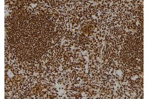 ABIN6264437 and ABIN6269102 at 1/100 staining Mouse spleen tissue by IHC-P. (Progesterone Receptor anticorps)