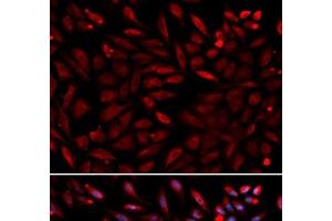 Immunofluorescence analysis of U2OS cells using PSMC2 Polyclonal Antibody