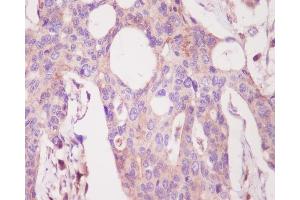 Immunohistochemical analysis of paraffin-embedded human colon, using PKC alpha Antibody.