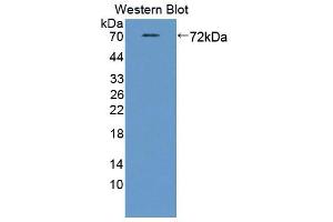 Western blot analysis of the recombinant protein. (STAM2 anticorps  (AA 1-377))