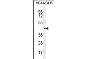 OR2L13 Antibody (C-term) (ABIN655220 and ABIN2844829) western blot analysis in MDA-M cell line lysates (35 μg/lane). (OR2L13 anticorps  (C-Term))