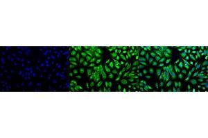 Immunocytochemistry/Immunofluorescence analysis using Rabbit Anti-PDI Polyclonal Antibody (ABIN361828 and ABIN361829). (P4HB anticorps  (AA 409-509))