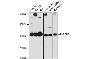 Western blot analysis of extracts of various cell lines, using RHBDD1 antibody (ABIN7269978) at 1:1000 dilution. (RHBDD1 anticorps  (AA 206-315))
