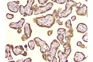 IHC analysis of Cyclophilin B using anti-Cyclophilin B antibody (ABIN6719475).