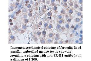 Image no. 1 for anti-Scavenger Receptor Class B, Member 1 (SCARB1) antibody (ABIN791178) (SCARB1 anticorps)