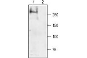 Western blot analysis of rat skeletal muscle lysate: - 1. (SCN4A anticorps  (Intracellular))