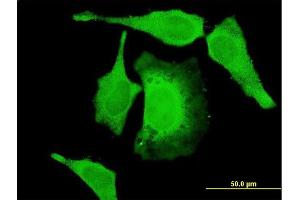 Immunofluorescence of monoclonal antibody to PAN2 on HeLa cell.
