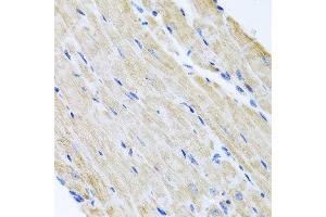 Immunohistochemistry of paraffin-embedded mouse heart using ABCB8 antibody at dilution of 1:100 (x40 lens). (ABCB8 anticorps)