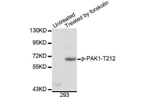 Western blot analysis of extracts of 293 cells, using Phospho-PAK1-T212 antibody (ABIN5996121). (PAK1 anticorps  (pThr212))