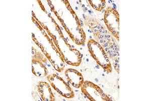 Immunohistochemical analysis of paraffin-embedded H. (Cystin 1 anticorps  (C-Term))