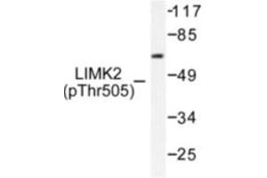 Image no. 1 for anti-LIM Domain Kinase 2 (LIMK2) (pThr505) antibody (ABIN318064) (LIMK2 anticorps  (pThr505))
