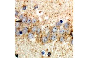 Immunohistochemical analysis of ABCB8 staining in rat brain formalin fixed paraffin embedded tissue section. (ABCB8 anticorps)