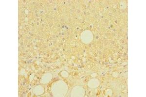 Immunohistochemistry of paraffin-embedded human adrenal gland tissue using ABIN7158146 at dilution of 1:100 (LRRC19 anticorps  (AA 25-270))