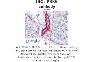 Image no. 3 for anti-PRKG antibody (ABIN1738352) (PRKG anticorps)