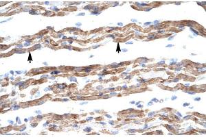Human Muscle; HumanMuscle; PQBP1 antibody - middle region in Human Muscle cells using Immunohistochemistry (PQBP1 anticorps  (Middle Region))