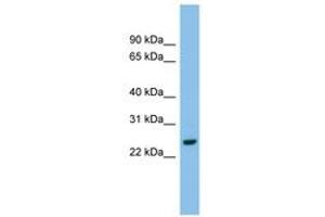 Image no. 1 for anti-Adenylate Kinase 2 (AK2) (AA 143-192) antibody (ABIN6744817) (Adenylate Kinase 2 anticorps  (AA 143-192))