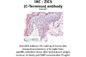 Image no. 2 for anti-Zinc Family Member 5 (ZIC5) (C-Term) antibody (ABIN1740919) (ZIC5 anticorps  (C-Term))