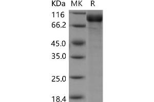 Western Blotting (WB) image for Sema Domain, Seven thrombospondin Repeats (Type 1 and Type 1-Like), Transmembrane Domain (TM) and Short Cytoplasmic Domain, (Semaphorin) 5A (SEMA5A) protein (His tag) (ABIN7320088)