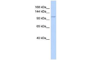 WB Suggested Anti-ZC3H7B Antibody Titration: 0. (ZC3H7B anticorps  (Middle Region))