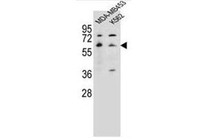 Western blot analysis of HTR3A Antibody (N-term) in MDA-MB453, K562 cell line lysates (35ug/lane). (Serotonin Receptor 3A anticorps  (N-Term))