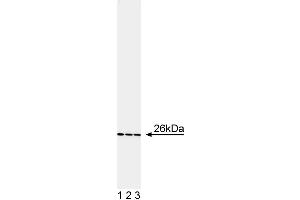 Western blot analysis of bcl-2. (Bcl-2 anticorps  (AA 61-76))