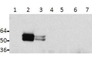 Western blot analysis of lysates from HeLa transfected cells: 1: Tau, 2: Tau + Fyn, 3: Tau + Src, 4: non-transfected, 5: TauY18F, 6: TauY18F + Fyn, 7: TauY18F + Src