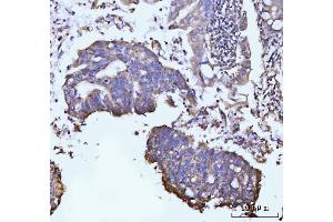 IHC analysis of GLUL using anti-GLUL antibody (ABIN7602403). (GLUL anticorps  (AA 74-373))