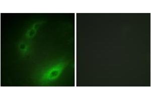 Immunofluorescence analysis of HuvEc cells, using FOXO1A (Ab-329) Antibody. (FOXO1 anticorps  (AA 295-344))