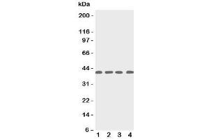 Western blot testing of p53R2 antbody; Lane 1: rat thymus;  2: human MCF-7;  3: (h) A431;  4: (h) HeLa cell lysate. (RRM2B anticorps  (C-Term))