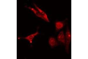 ABIN6277006 staining  COLO205 cells by IF/ICC. (PSMD2 anticorps  (C-Term))