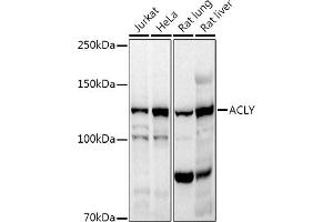 ACLY antibody  (AA 752-1101)