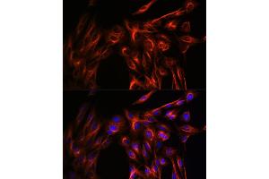 Immunofluorescence analysis of U-2 OS cells using α-Tubulin Rabbit pAb (ABIN3020549, ABIN3020550 and ABIN3020551) at dilution of 1:100 (40x lens). (TUBA4A anticorps  (AA 1-180))