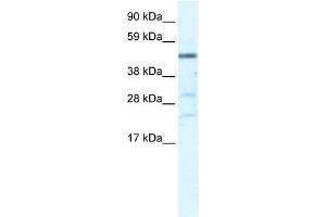 Western Blot showing HSFY1 antibody used at a concentration of 1-2 ug/ml to detect its target protein. (HSFY1 anticorps  (N-Term))