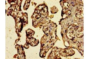 Immunohistochemistry of paraffin-embedded human placenta tissue using ABIN7174832 at dilution of 1:100 (C3ORF14 anticorps  (AA 9-128))