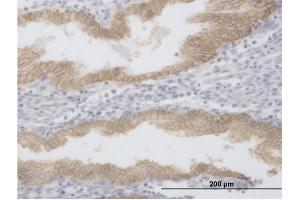 Immunoperoxidase of purified MaxPab antibody to EPCAM on formalin-fixed paraffin-embedded human endometrium.
