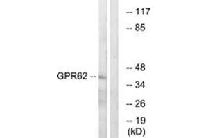 Western blot analysis of extracts from COLO cells, using GPR62 Antibody. (GPR62 anticorps  (AA 181-230))