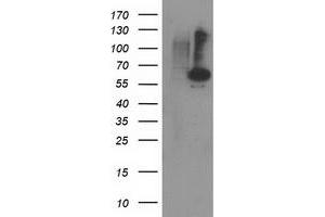 Western Blotting (WB) image for anti-Protein Phosphatase, Mg2+/Mn2+ Dependent, 1B (PPM1B) antibody (ABIN1500373) (PPM1B anticorps)