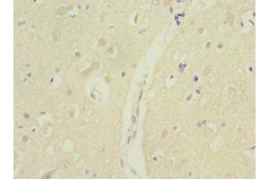 Immunohistochemistry of paraffin-embedded human brain tissue using ABIN7172732 at dilution of 1:100 (MTERFD1 anticorps  (AA 69-300))
